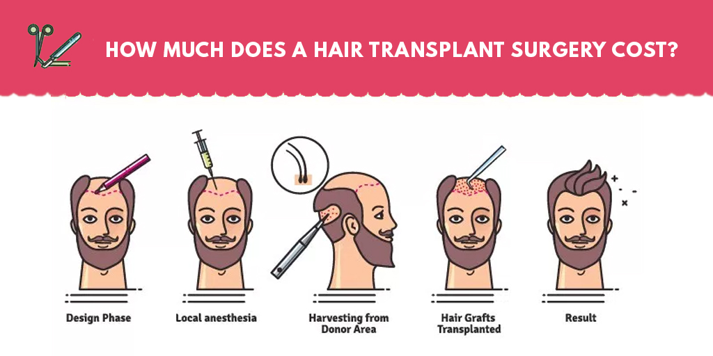 hair transplant cost