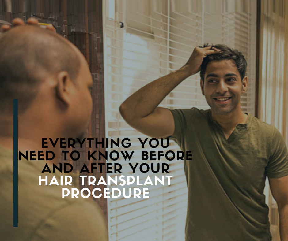 hair transplant procedure